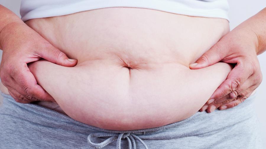 Минздрав: четверть россиян страдают от ожирения