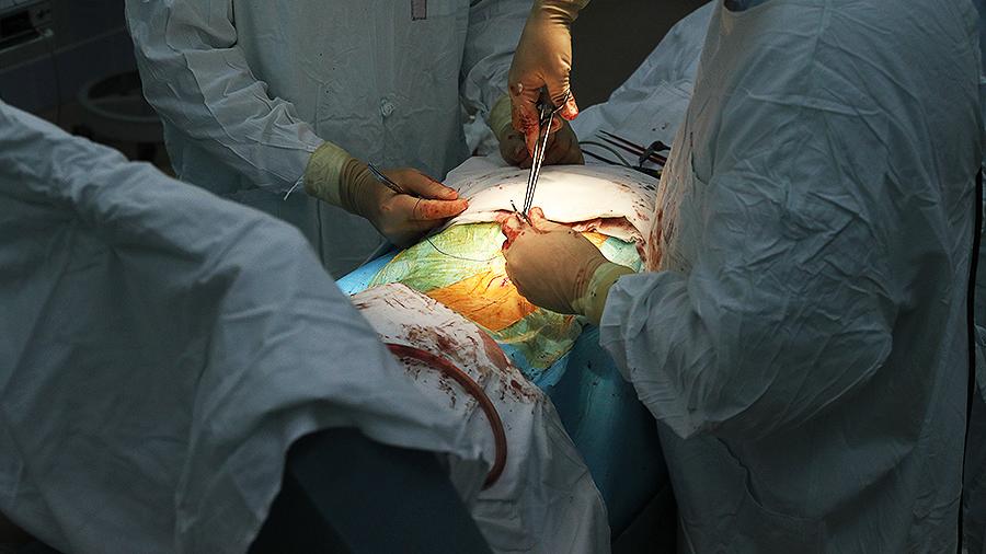 Смертельный аппендикс: опасная операция грозит ранней смертью